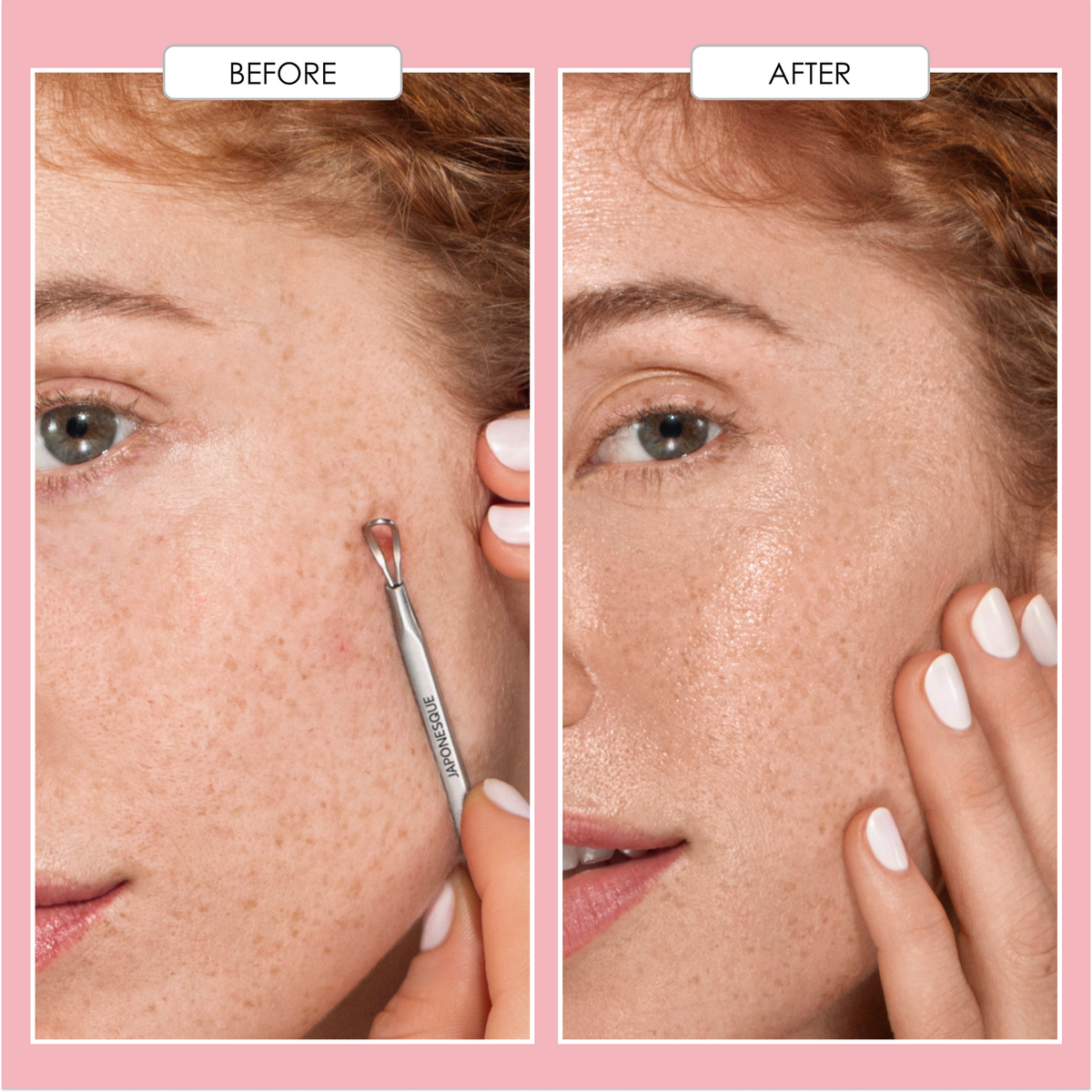 Porefection Clear Skin Set